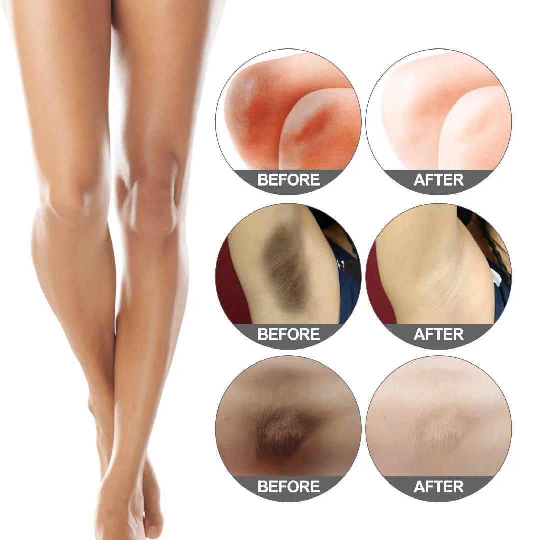 Snow Bleach Cream (30ml) | Intensive Skin Brightening Solution for Face and Body